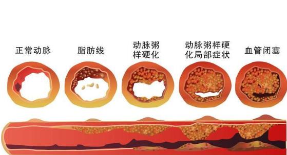 每天吃点它，溶栓降脂护血管，吃掉百病、吃出健康！太实用了